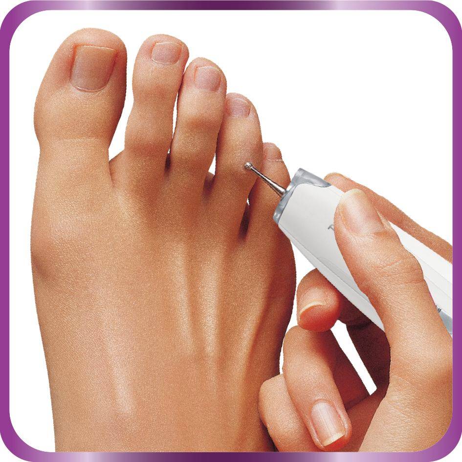 EXPERT SET 11 accessoires